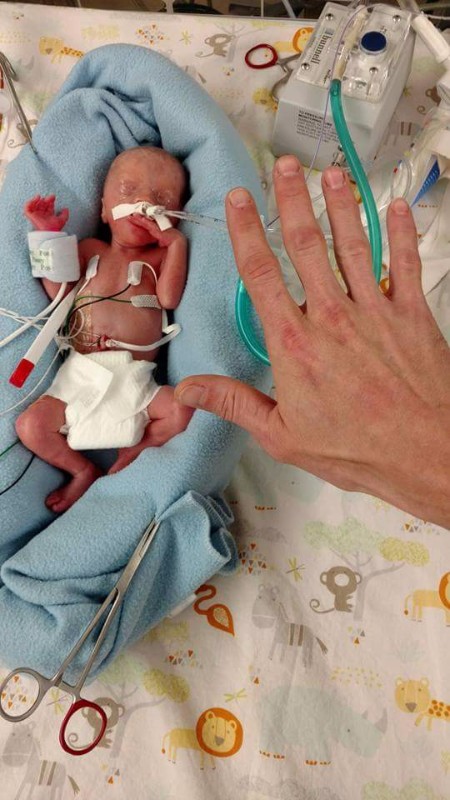 Fundraiser for Angel Burch by Arianna Engler : Talon Tuesday- Fight ...