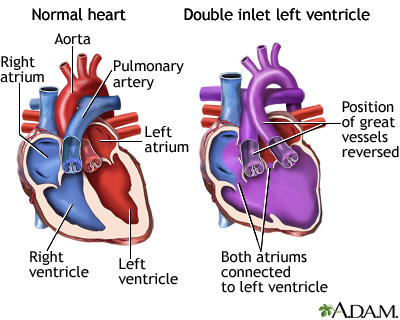 Fundraiser by Bobby Duquette : Trevor's Fontan (Heart) Surgery Fund