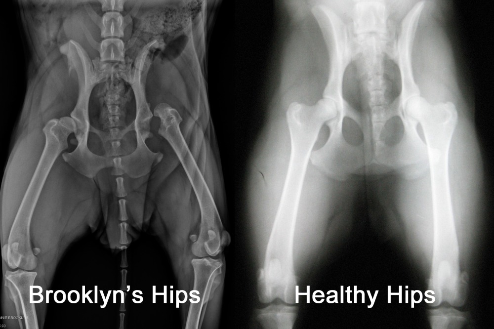 Fundraiser by Liz Rennie : Brooklyn's Hip Surgery