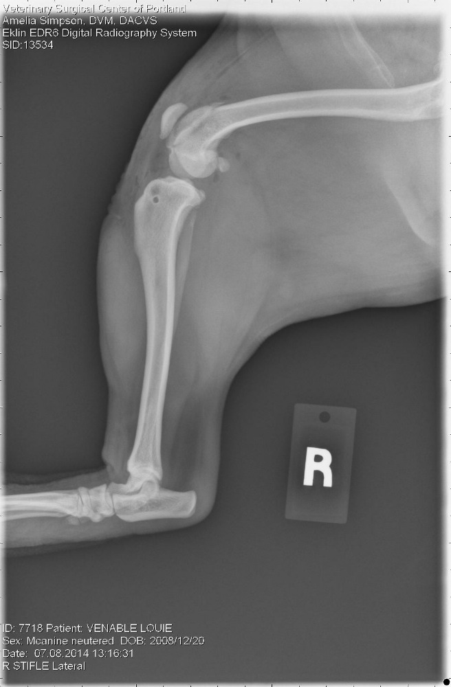 Fundraiser by Ptown N Louie Louie's Double Knee Surgery