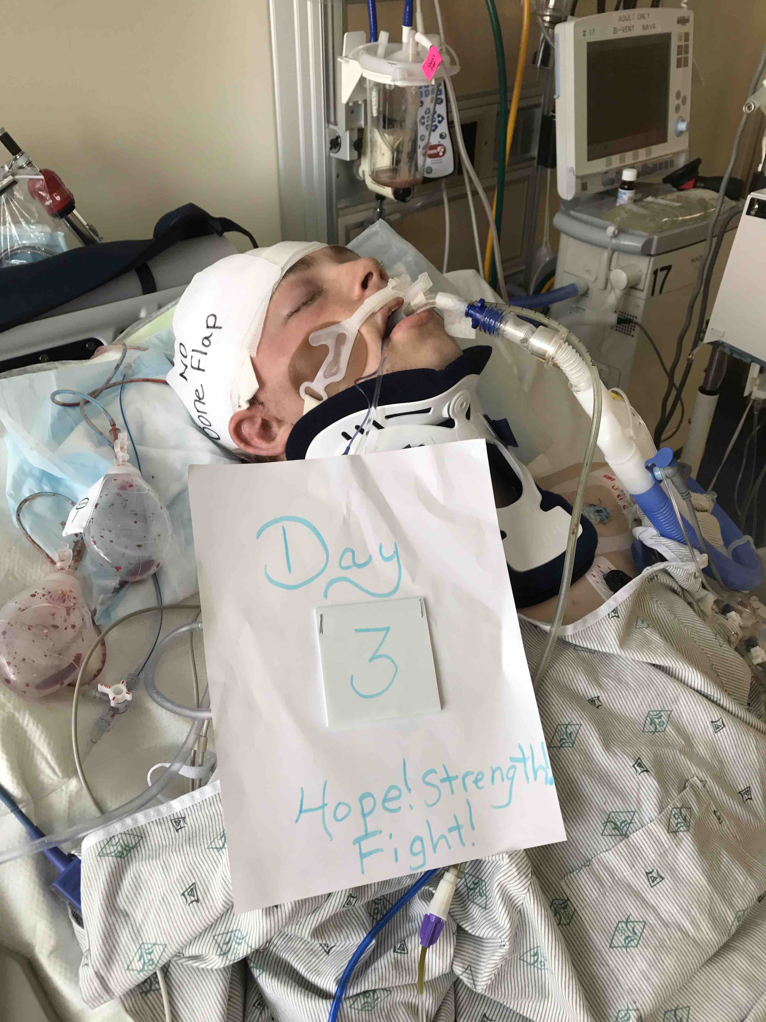 Bonicelli'S Horrific Accident:  Neck Surgery, Coma, Team Withdrawal – Details Inside - egistnn