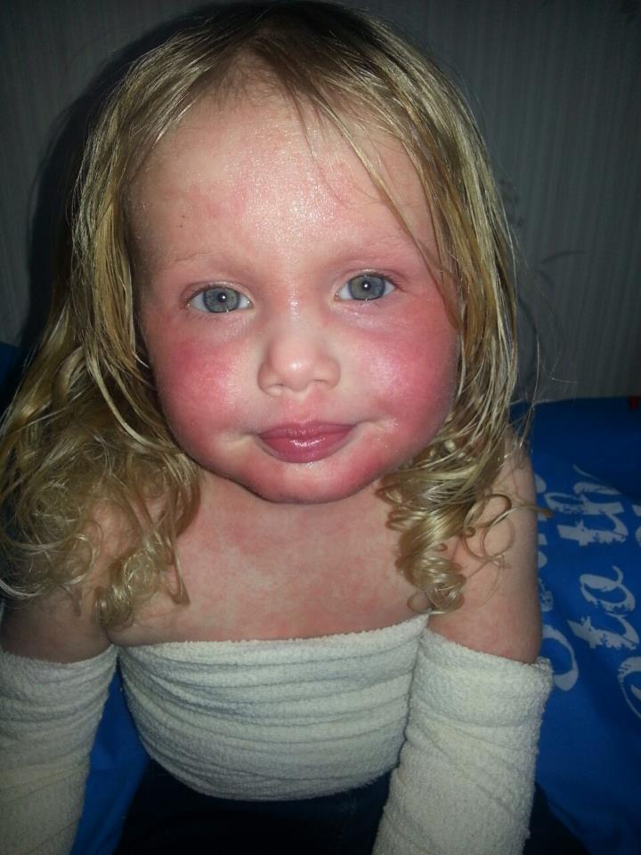 Mom Says Strangers 'Shout Abuse' At 5-Year-Old Daughter With Sun ...