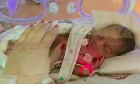 Preemie Baby & Hubby Brain surgery photo