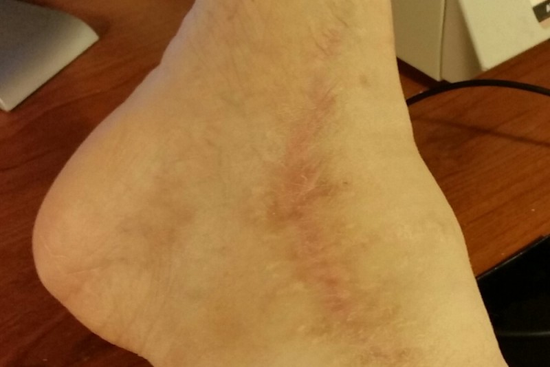 HELP ME GET MY FEET help me get my feet: