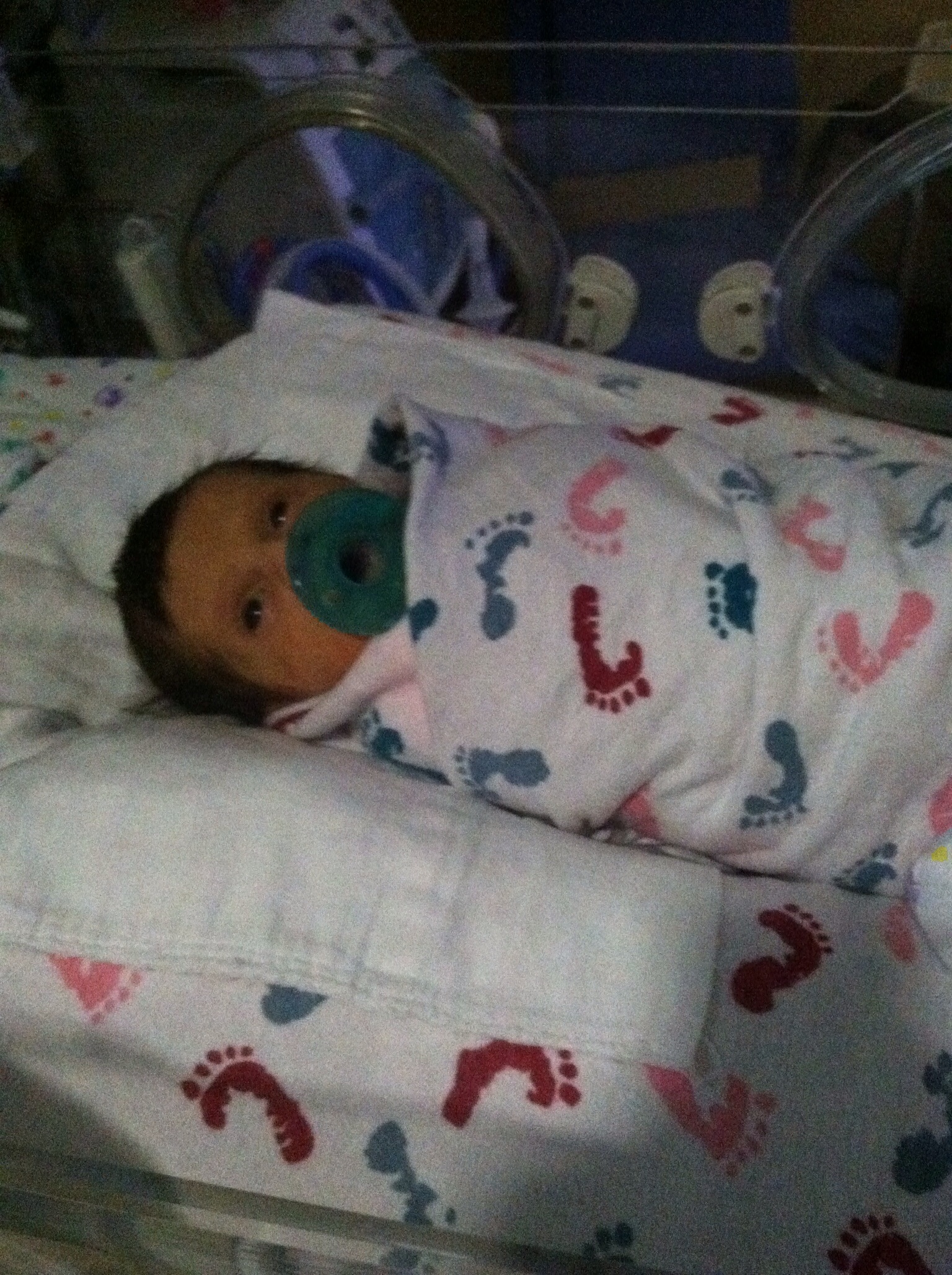 Fundraiser by Tami Steffens Leone Miracle baby surviving Potters