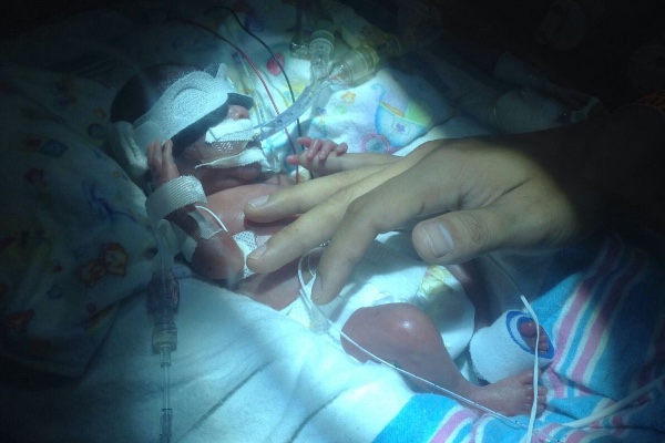 Micro preemie  photo
